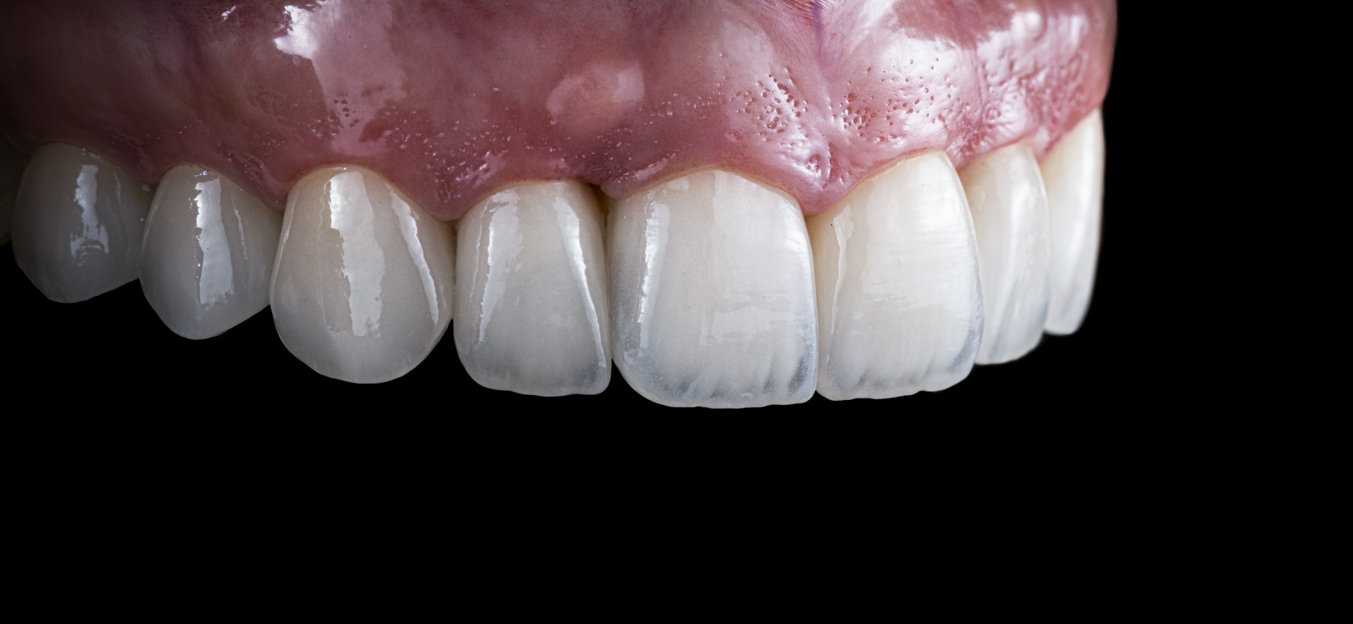 Co niszczy naturalne szkliwo zębów?