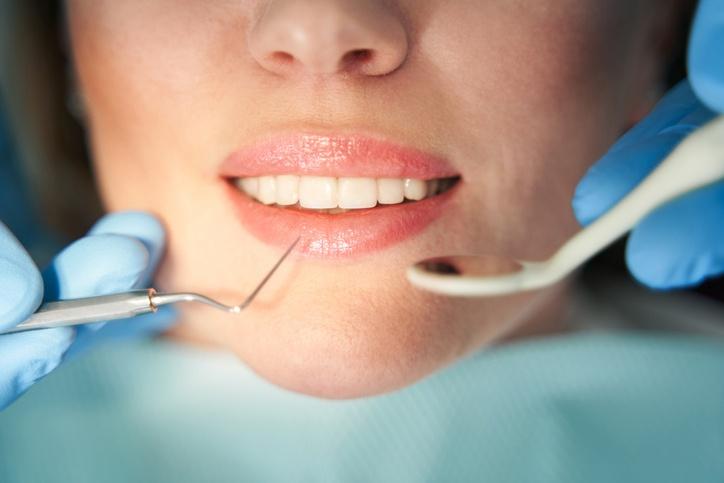 dentysta sprawdzający zęby kobiety